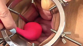 Cervix Vibration Play